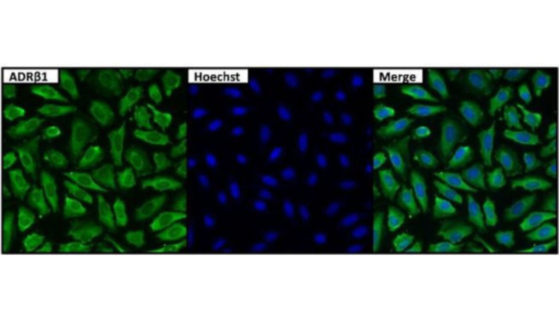 Beta 1 adrenergic receptor (B1AR) autoantibody